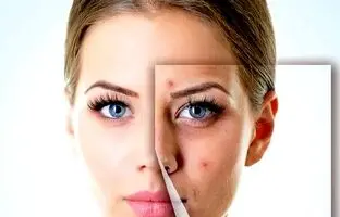 ده ژل شستشوی صورت مناسب برای پوست چرب و مستعد آکنه