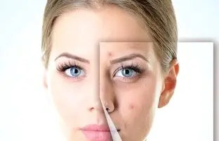 ده ژل شستشوی صورت مناسب برای پوست چرب و مستعد آکنه