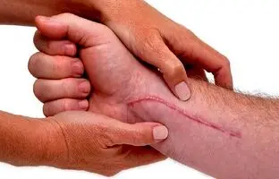 تغییر ساعت شبانه روزی می تواند به بهبود زخم کمک کند