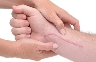 تغییر ساعت شبانه روزی می تواند به بهبود زخم کمک کند