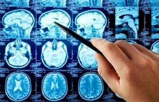 بازسازی تصاویر دقیق از فعالیت مغز با هوش مصنوعی