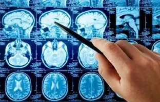 بازسازی تصاویر دقیق از فعالیت مغز با هوش مصنوعی