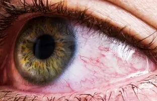 درمان موثر یک سرطان نادر اما کشنده