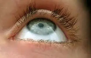 (ویدئو) رباتی که عمل زیبایی کاشت مژه انجام می دهد