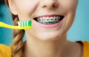 راهنمای خرید بهترین مسواک ارتودنسی