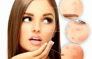 راهنمای خرید بهترین کرم های ترمیم کننده زخم