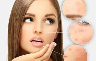 راهنمای خرید بهترین کرم های ترمیم کننده زخم