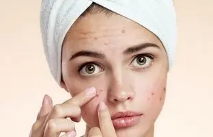 بهترین صابون آنتی باکتریال ضد جوش و آکنه