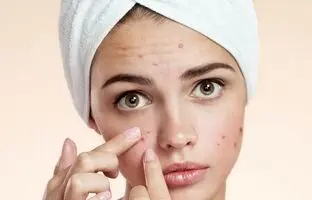 بهترین صابون آنتی باکتریال ضد جوش و آکنه