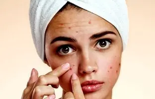 بهترین صابون آنتی باکتریال ضد جوش و آکنه