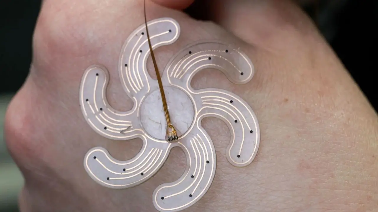 ساخت ایمپلنت جمجمه نرم که می‌تواند درمان صرع را متحول کند