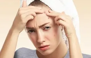 این کارارو بکن تا صورتت بیشتر جوش بزنه!