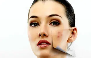 دو بار این ماسکو بزنی لک‌های پوستت از بین می‌ره!
