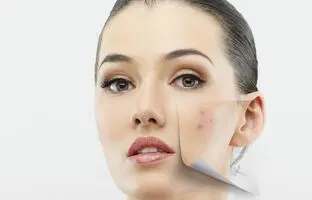 دو بار این ماسکو بزنی لک‌های پوستت از بین می‌ره!