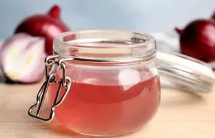 با ماسک پیاز رشد موهاتو ده برابر کن!