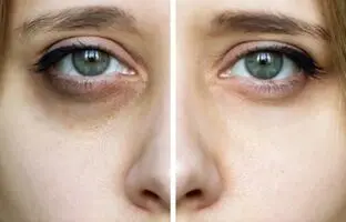 باورهای رایج اما اشتباه درباره مراقبت های پوستی که تنها پول تان را هدر می دهند