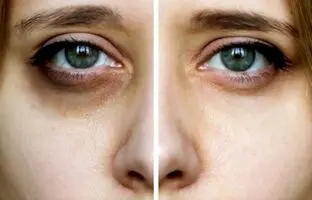 باورهای رایج اما اشتباه درباره مراقبت های پوستی که تنها پول تان را هدر می دهند