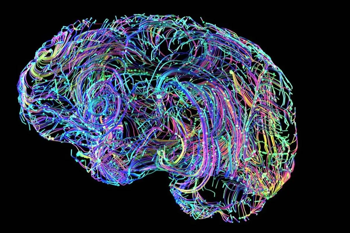 مغز از 40سالگی به بعد دوباره «سیم‌پیچی» می‌شود!