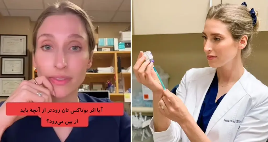 تزریق بوتاکس چقدر ماندگاری دارد و زمان دقیق اثربخشی آن چه مدت است؟