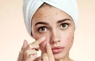 بهترین کرم های ضد جوش و آکنه خارجی