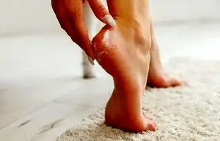 با این ۵ کرم معجزه آسا از شر ترک پا خلاص شوید!
