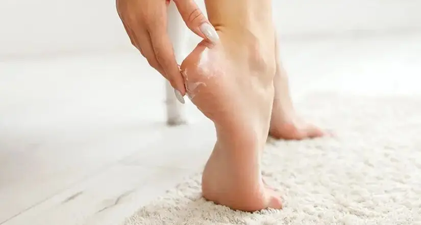 با این ۵ کرم معجزه آسا از شر ترک پا خلاص شوید!