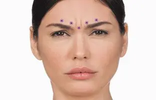 با خط اخم پیشانی خداحافظی کن! خیلی ارزان و ساده!