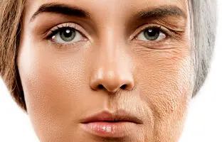 چگونه با ۶ عادت ساده روزمره، پیری پوست خود را به تاخیر بیندازیم؟