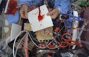 در فقدان جاذبه چگونه می توان جرایم منجر به خونریزی در فضا را بررسی کرد؟