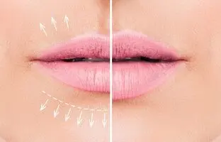 با این رژ لب حجم دهنده دیگه لازم نیست لبت رو ژل بزنی