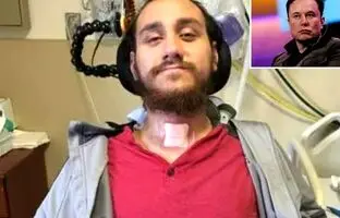 (ویدئو) اولین دریافت کننده تراشه مغزی نورالینک بازی رایانه‌ای انجام داد