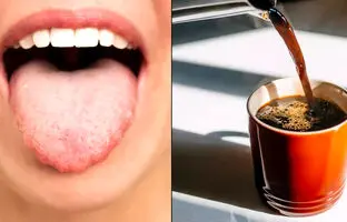 این نشانه روی زبان می‌گوید نباید قهوه بنوشید؛ رنگ‌های مختلف زبان نشانه چیست؟