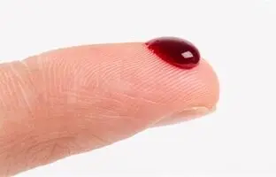 علائم نگران کننده که خبر از رقیق شدن خون می دهند