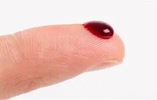 علائم نگران کننده که خبر از رقیق شدن خون می دهند