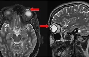 11مورد از عجیب‌ترین موارد پزشکی ثبت‌شده در جهان (بخش اول)