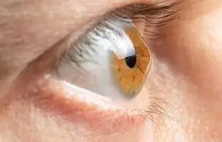 عامل مهم قوز قرنیه؛ این کار را نکنید