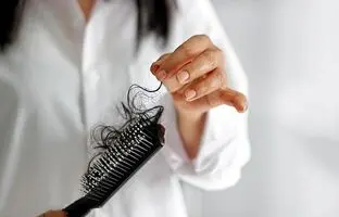 غذایی که باعث ریزش مو می‌شود / راه های کاهش ریزش مو به دلیل بالا رفتن سن