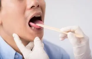 رنگ زبان نشانه چیست؟/ رنگ قرمز نشانه کمبود این ویتامین است