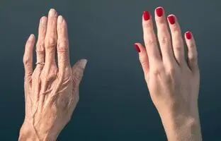 
بهترین روش‌ها برای مقابله و جلوگیری از چروک شدن پوست دستان
