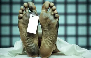 بدن انسان چگونه از زمان نزدیک‌بودن مرگ باخبر می‌شود؟ 