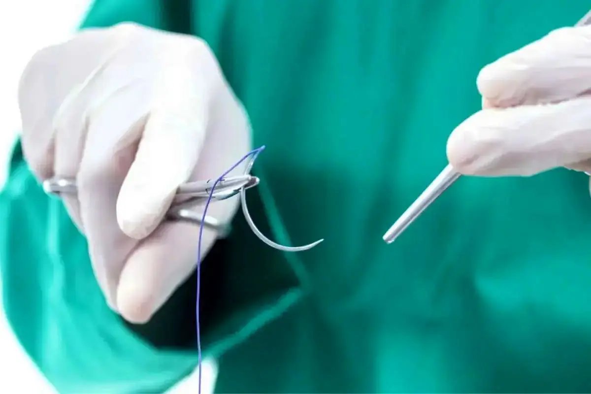  عودنوازی عجیب بیمار هنگام برداشت تومور مغزی + ویدئو