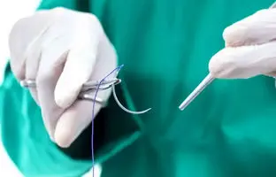  عودنوازی عجیب بیمار هنگام برداشت تومور مغزی + ویدئو