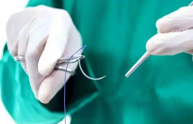  عودنوازی عجیب بیمار هنگام برداشت تومور مغزی + ویدئو