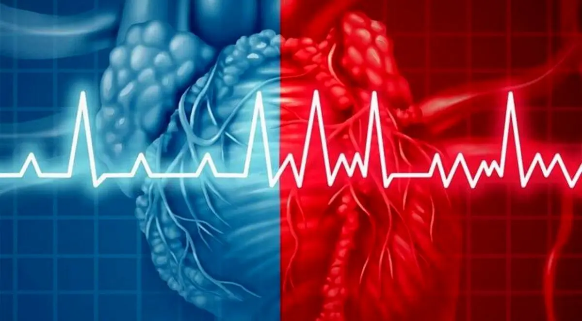 سن سکته قلبی در ایران به ۳۵ سال رسید؛ از هر ۵ فوتی یک نفر