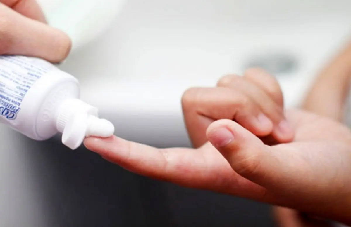 هشدار خطر مالیدن خمیردندان به پوست سوخته که نمی‌دانستید
