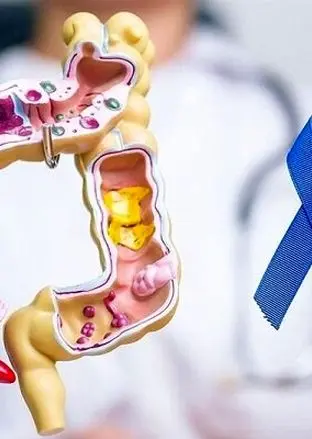 کدام افراد در معرض خطر سرطان روده هستند؟