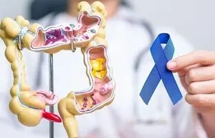 کدام افراد در معرض خطر سرطان روده هستند؟