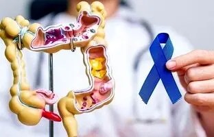 کدام افراد در معرض خطر سرطان روده هستند؟