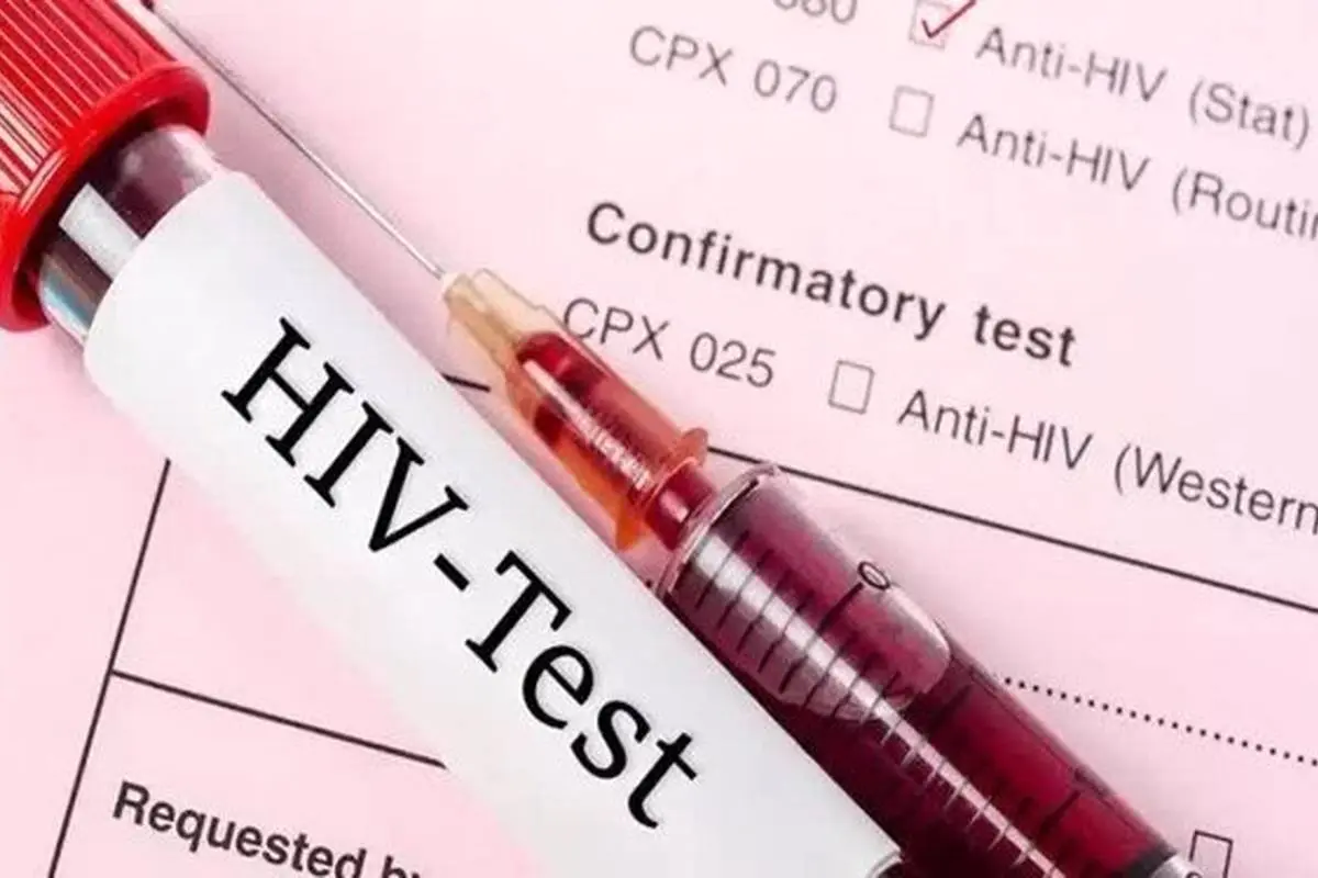 تعداد بیماران مبتلا به ایدز در کشور اعلام شد ؛ تفاوت قابل توجه تعداد مردان و زنان مبتلا به HIV (اچ‌آی‌وی)