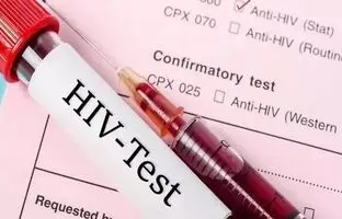تعداد بیماران مبتلا به ایدز در کشور اعلام شد ؛ تفاوت قابل توجه تعداد مردان و زنان مبتلا به HIV (اچ‌آی‌وی)